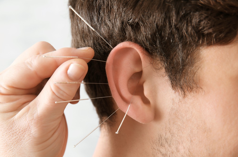 Which Diseases Can be Helped by Acupuncture?